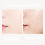 24K Gold Anti-Aging Toner – Hydrate & Refresh for Youthful, Acne-Free Skin